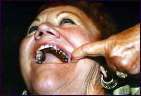 Yli 40.000 hammasihmett� 